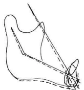 Manual Illustration